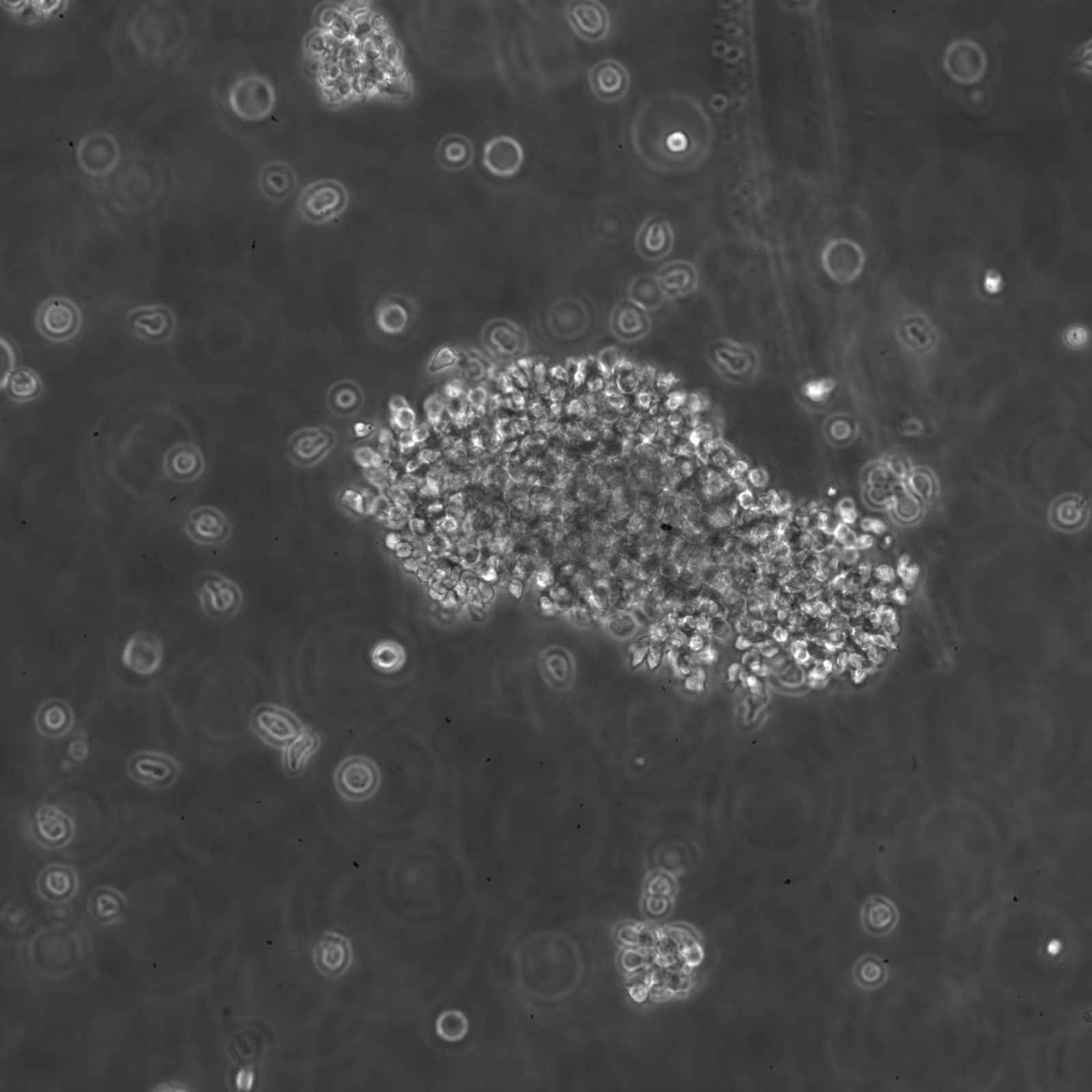 B-LCL-HROG04 Cells